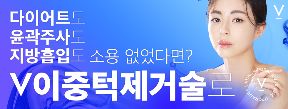 이중턱제거술