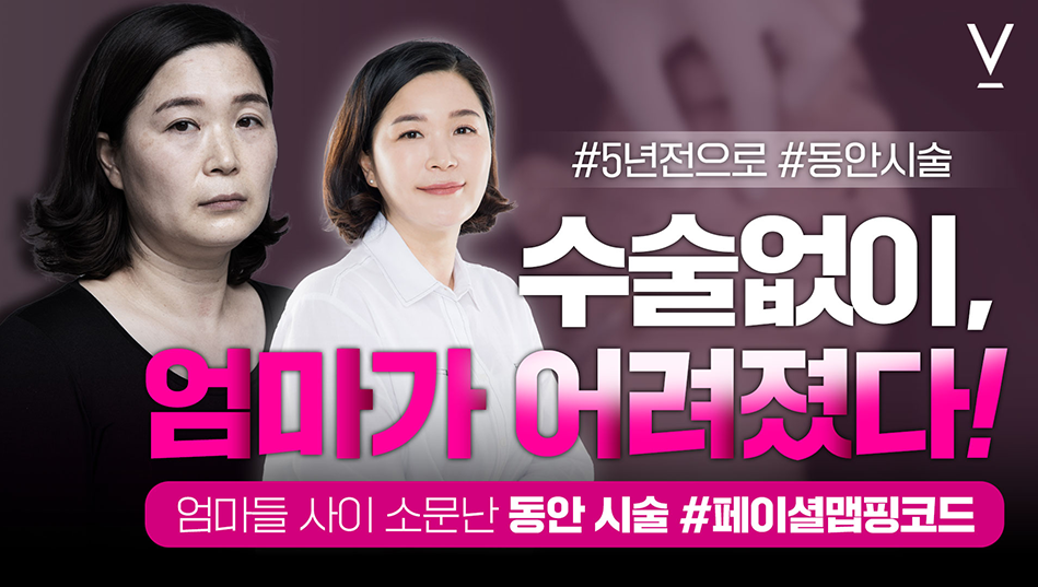 페이셜맵핑코드 동안시술