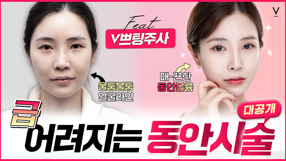 V쁘팅주사 급어려지는동안시술