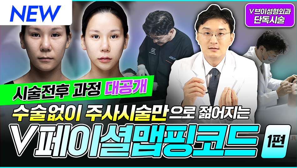 V페이셜맵칭코드 1편