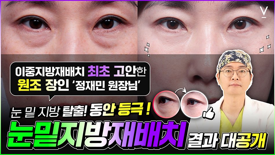 눈및지방재배치