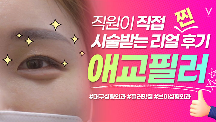 애교필러 리얼찐후기