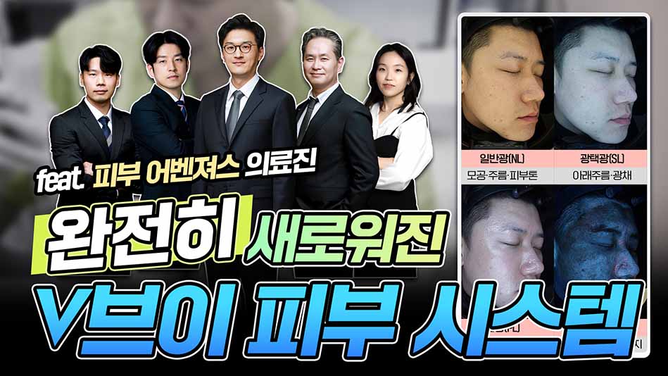 새로워진 v피부시스템