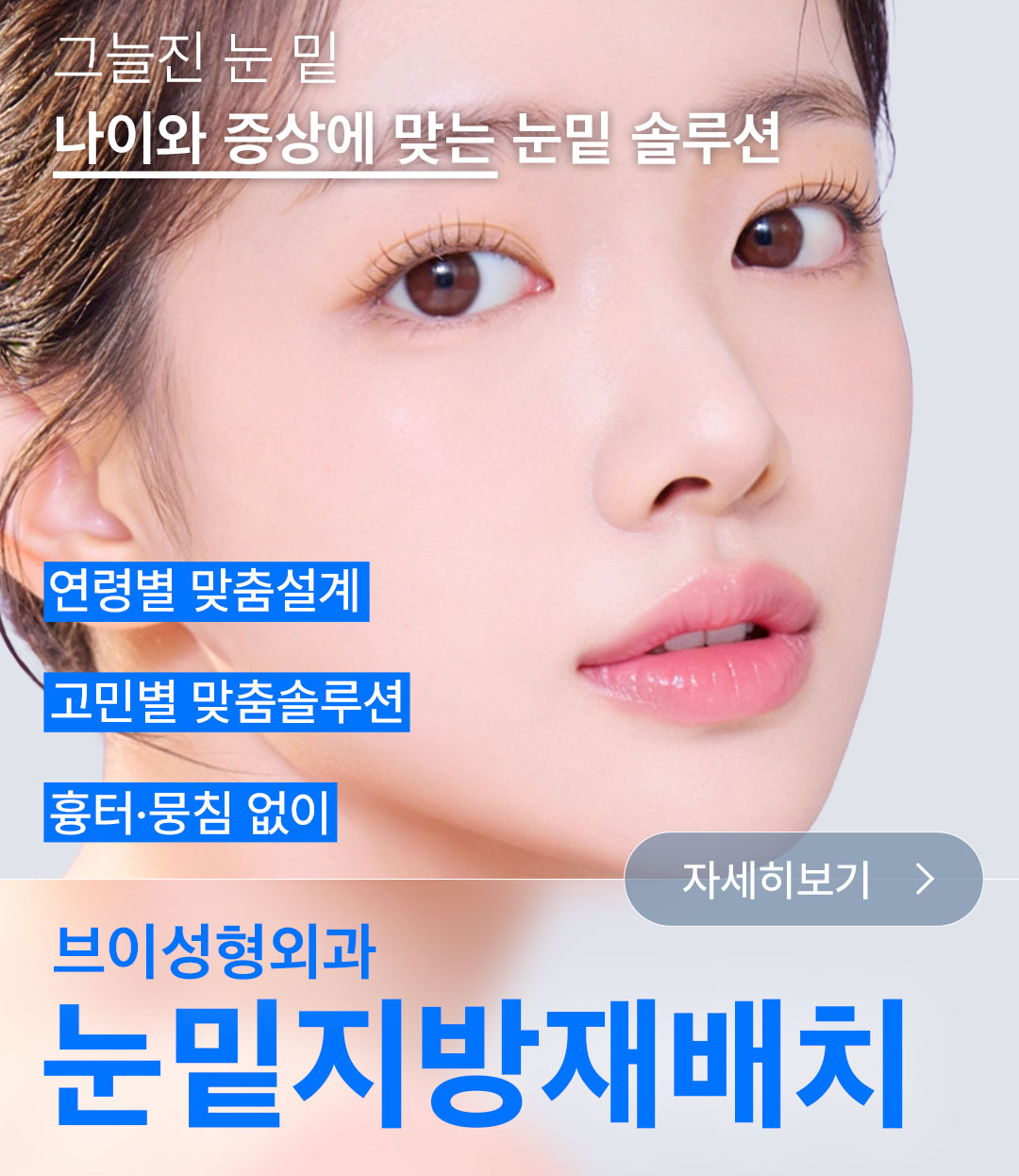 싱글_눈밑지방재배치